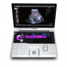 Vinno 5 Ultrasound